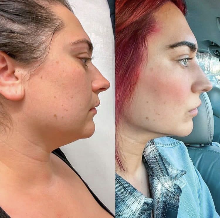 3. Your Face Is Bloated Because Your Gut Never Cleared Last Night