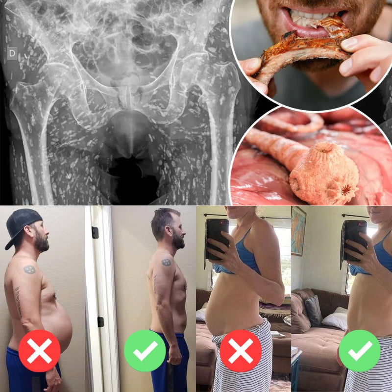 7. Your Lower Belly Is Not Stubborn Fat — It Is Your Colon Pushing Forward